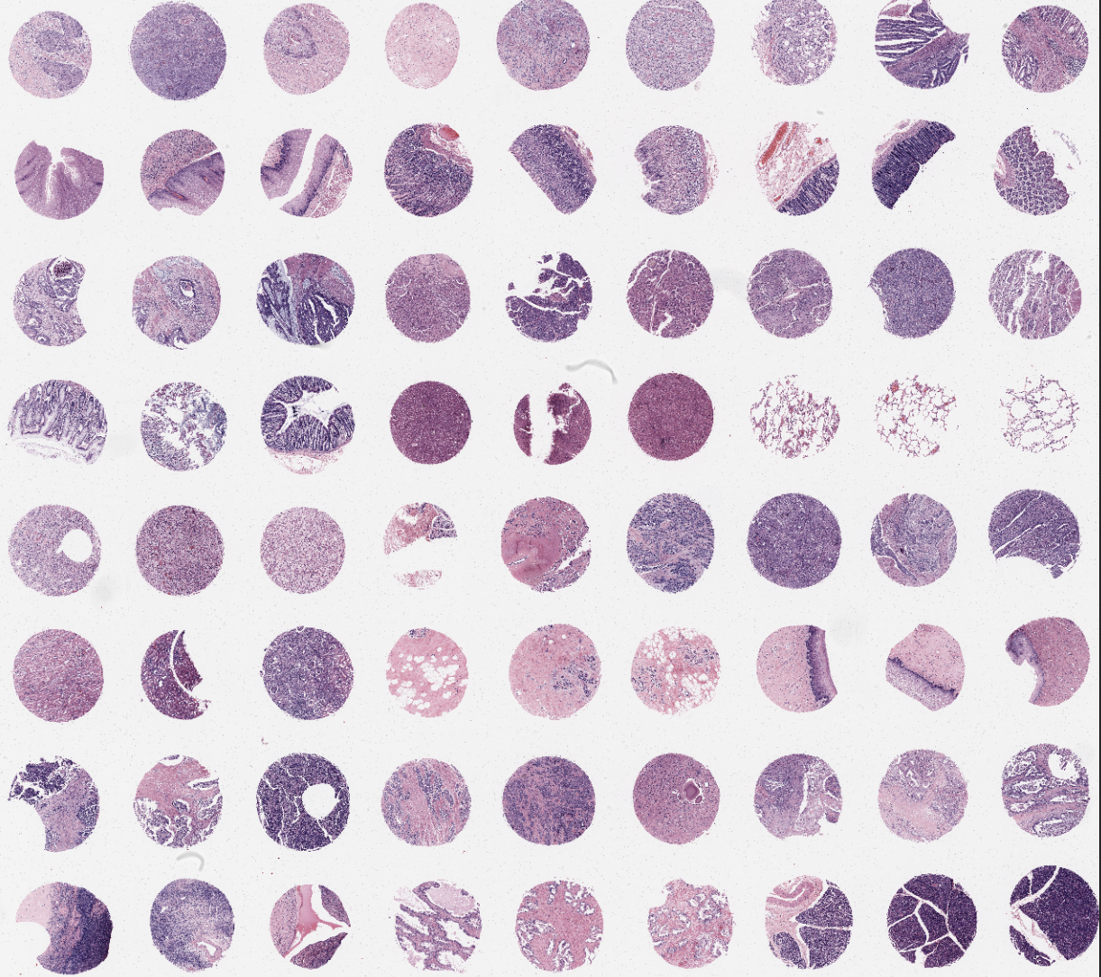 tissue microarray-BCN721