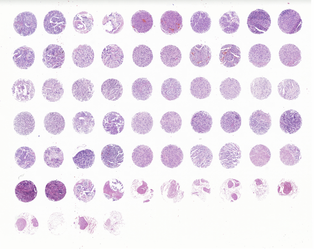 tissue microarray-YNB642b
