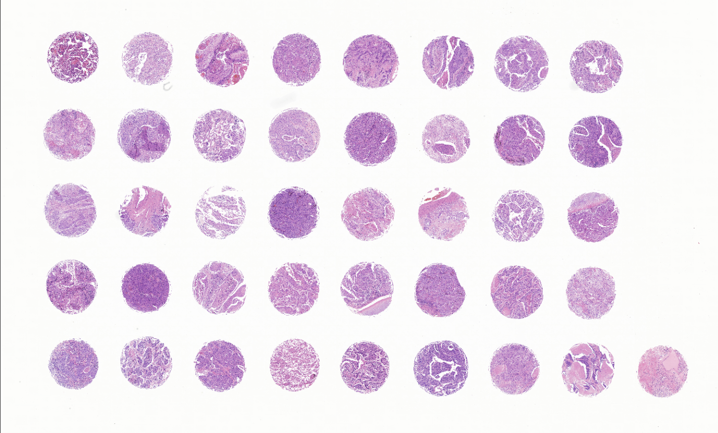 tissue microarray-RLN401b