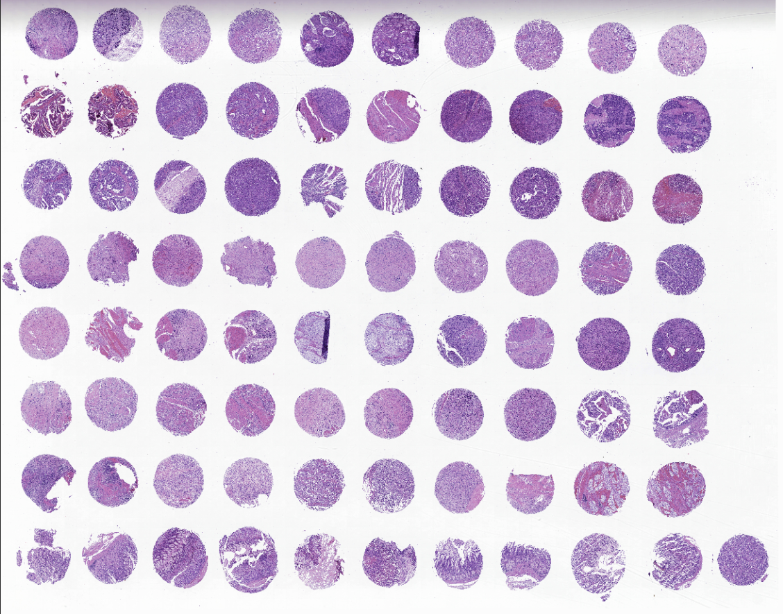 tissue microarray-DST1001b