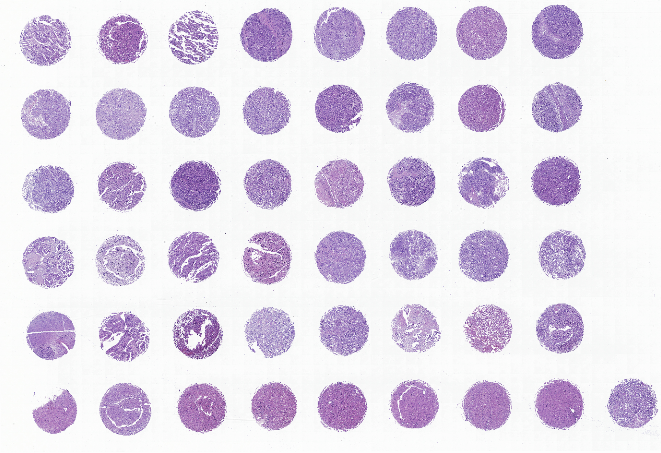 tissue microarray-DLV483