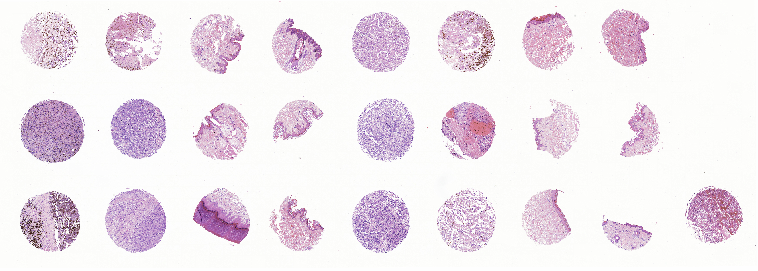 tissue microarray-MME242d
