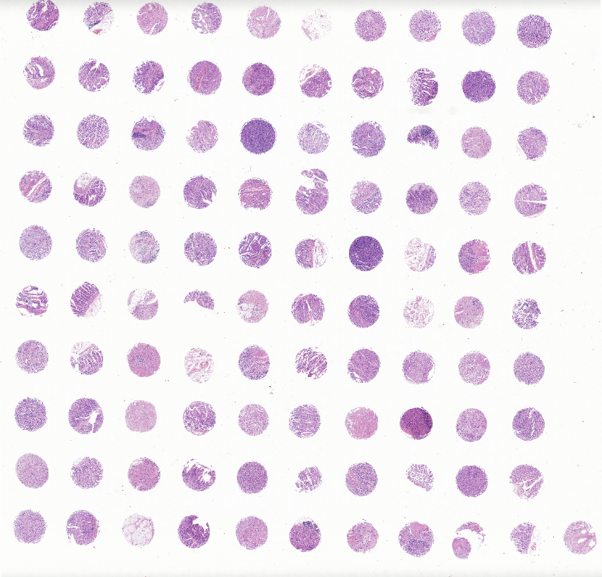 tissue microarray-DST1006a
