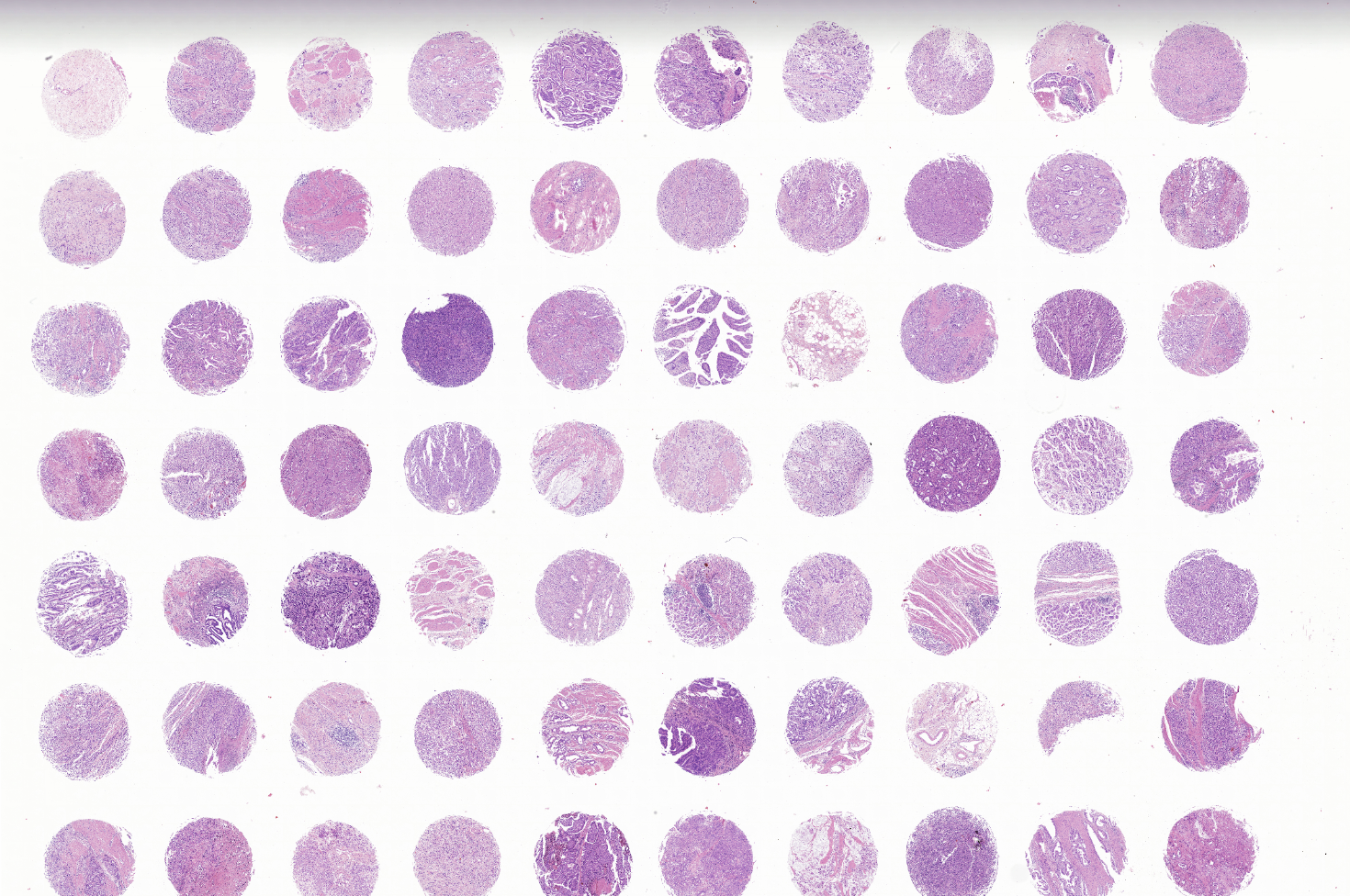 tissue microarray-DST8014b