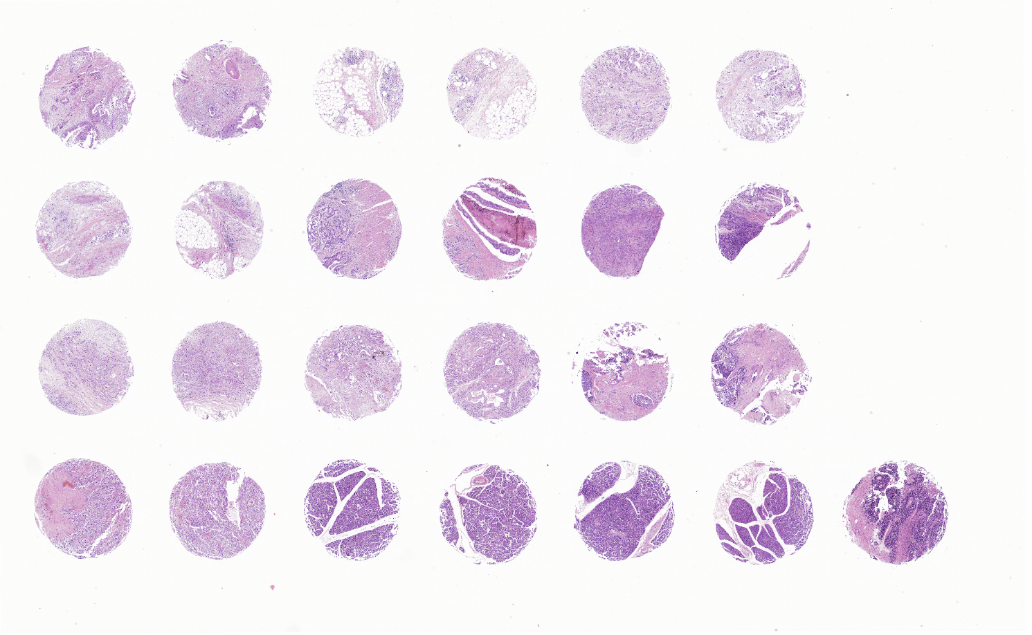 tissue microarray-DPA242f