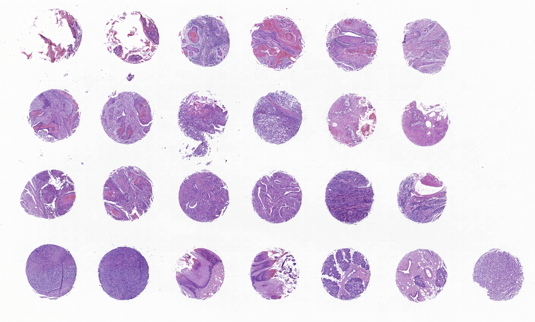 tissue microarray-XHN243