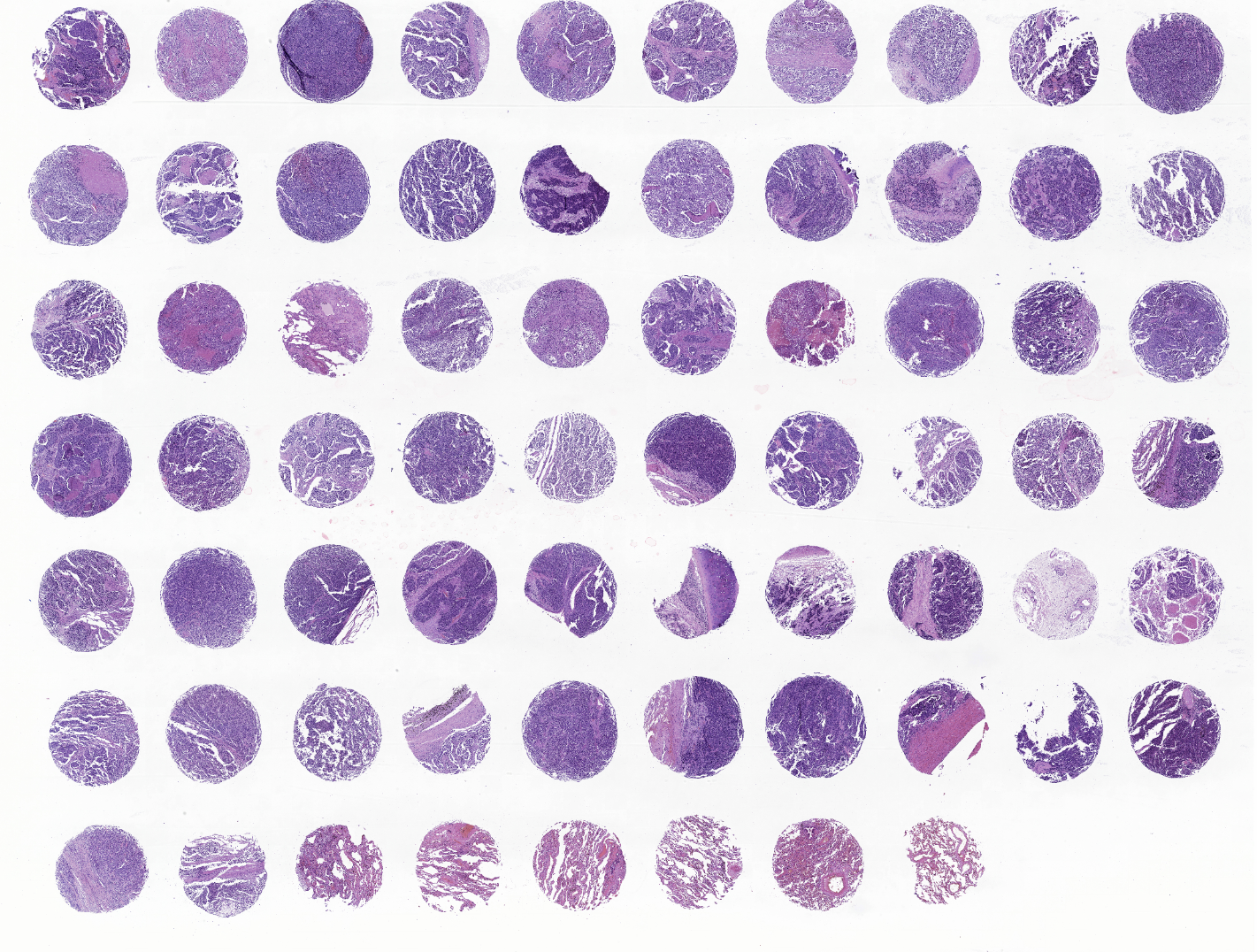 tissue microarray-RLN681