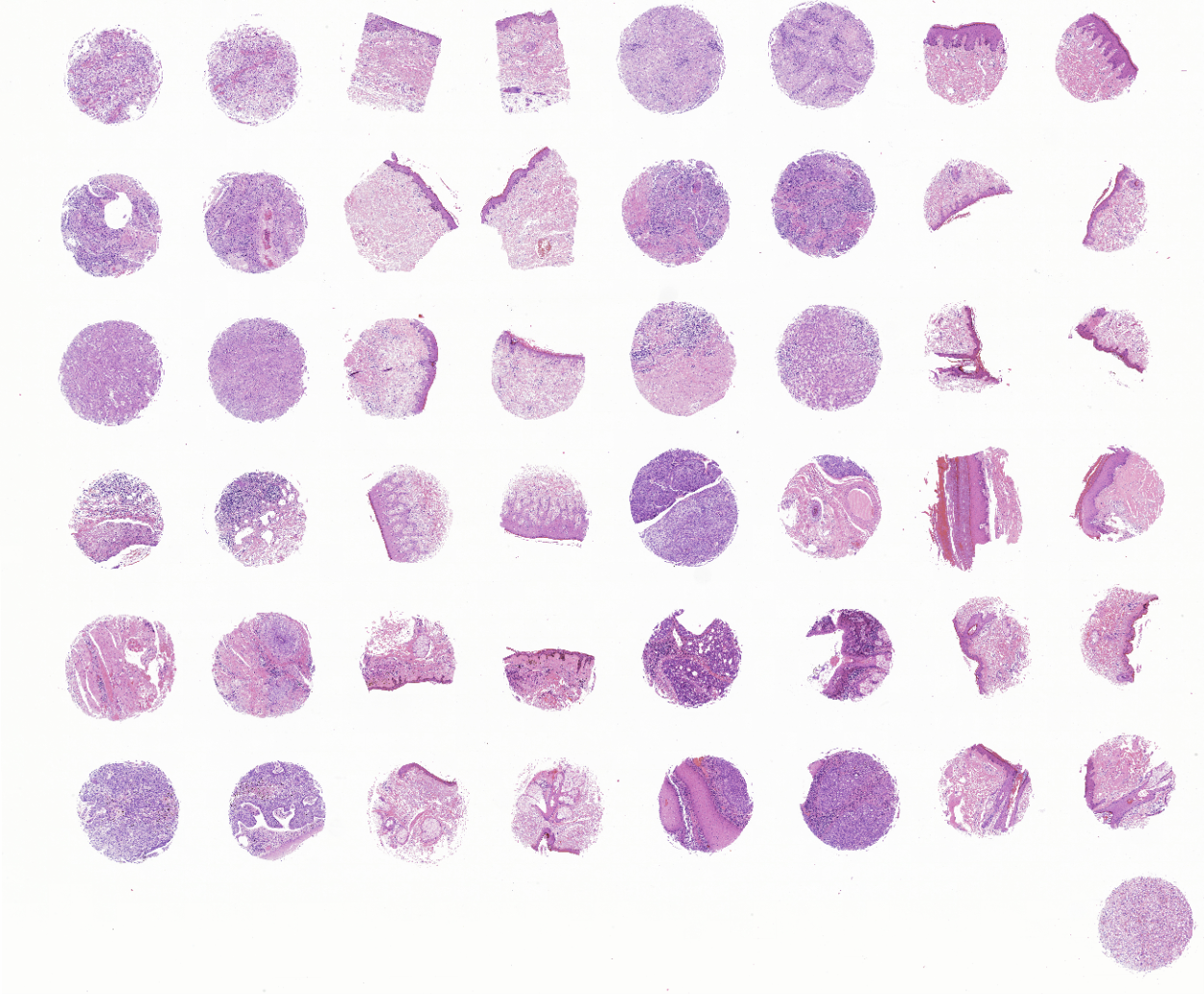 tissue microarray-KIN481b
