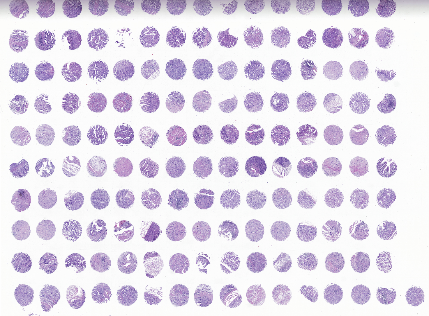 tissue microarray-DST1504
