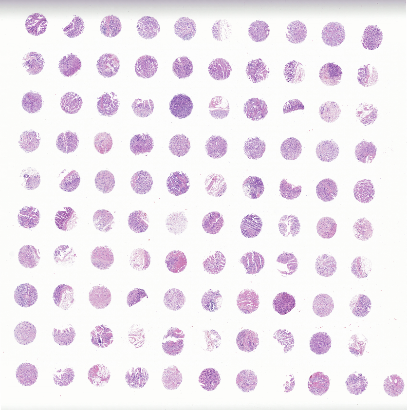 tissue microarray-DST1006