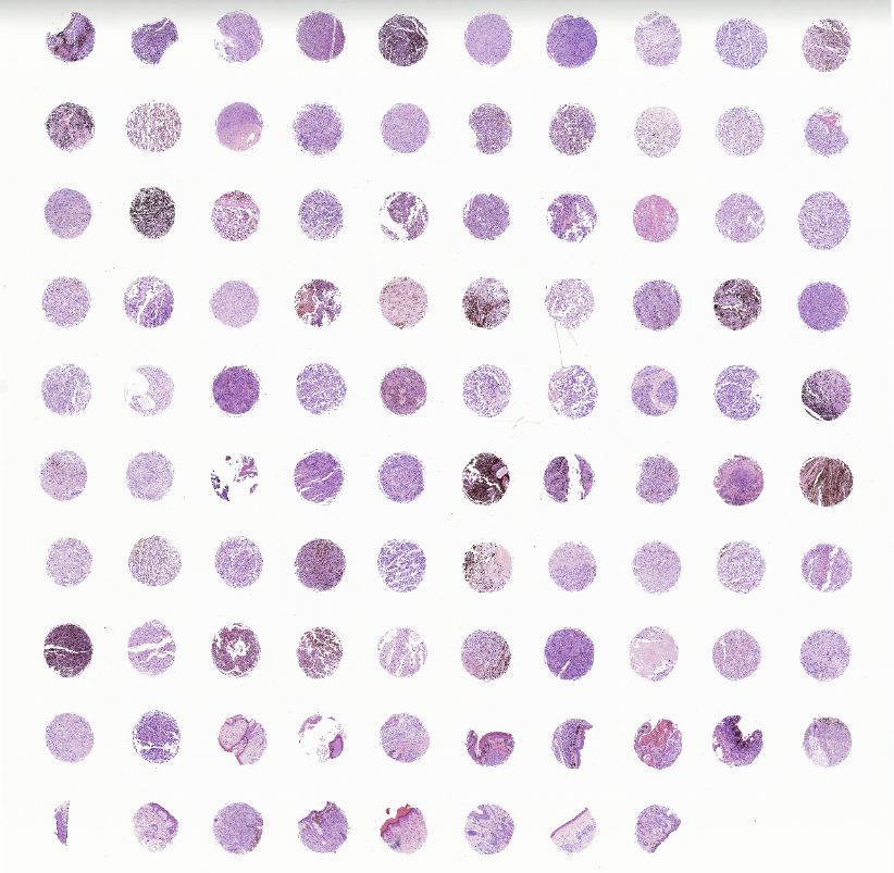 tissue microarray-MME981a