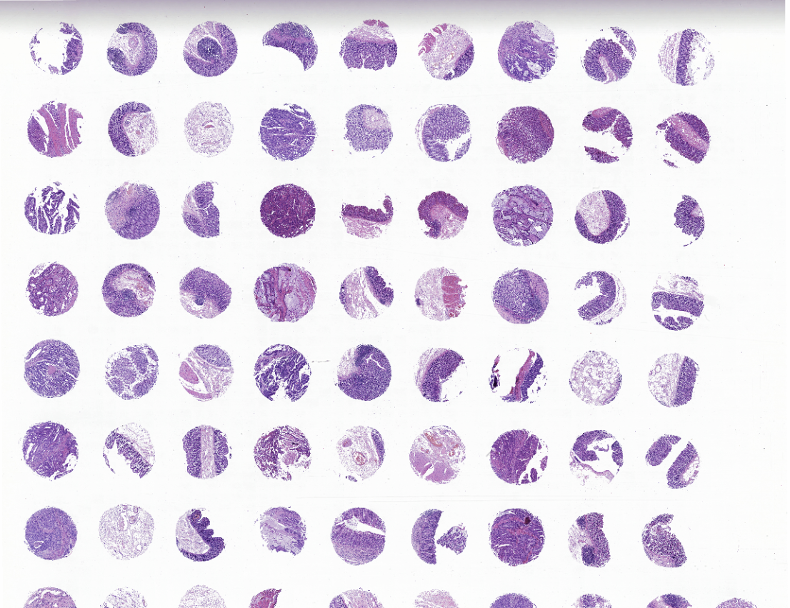 tissue microarray-DCO722a