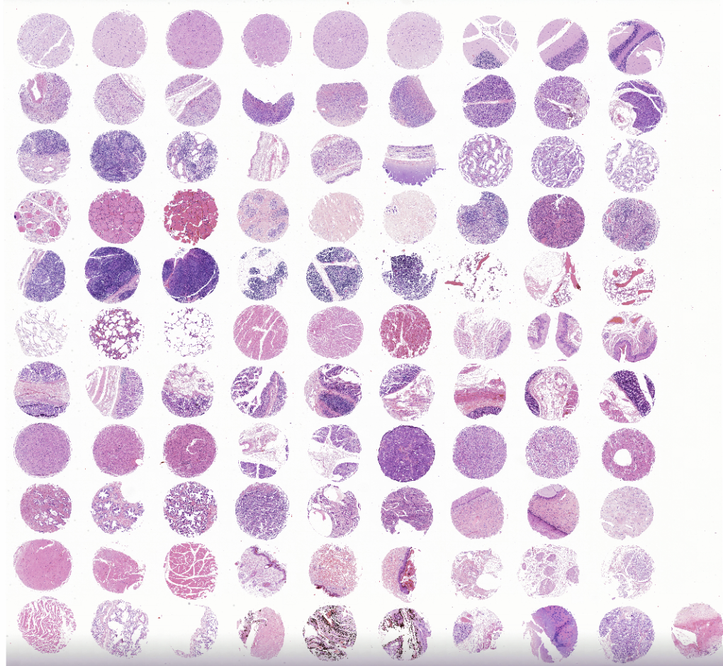 tissue microarray-FDA990a