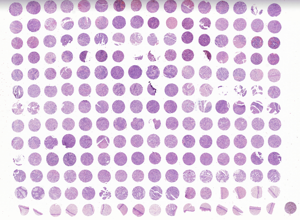 tissue microarray-FDU2083