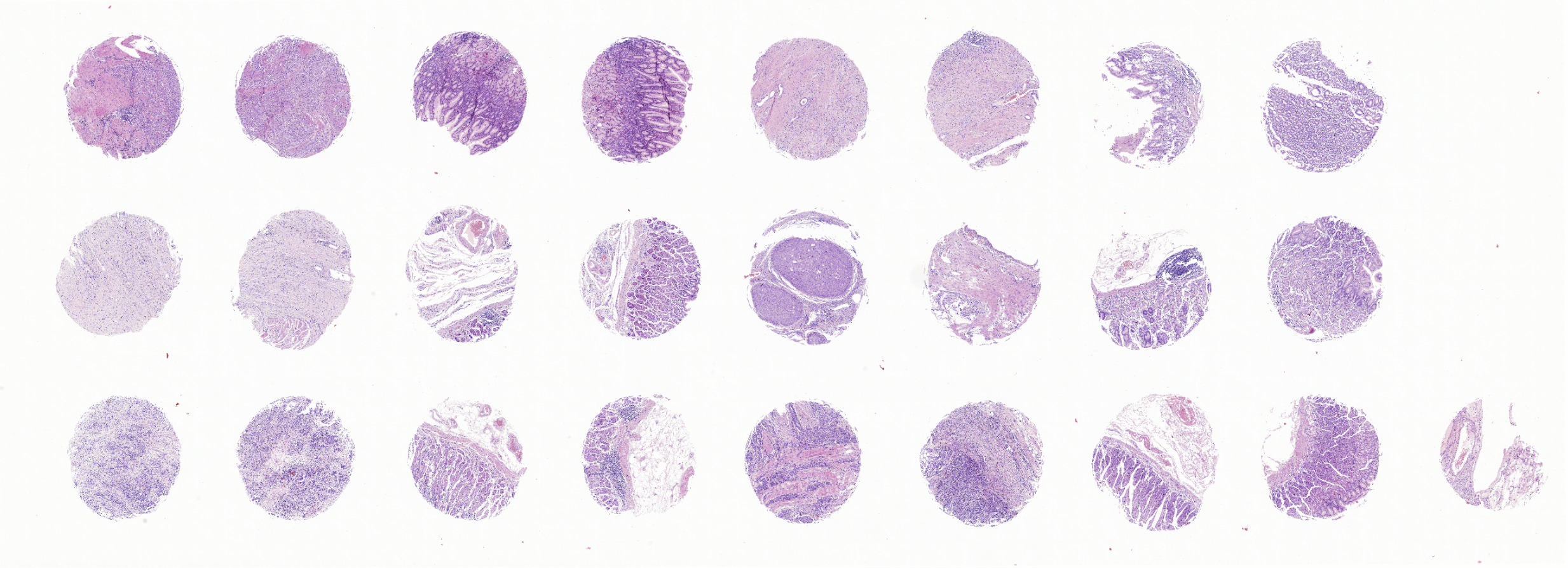 tissue microarray-DPA244