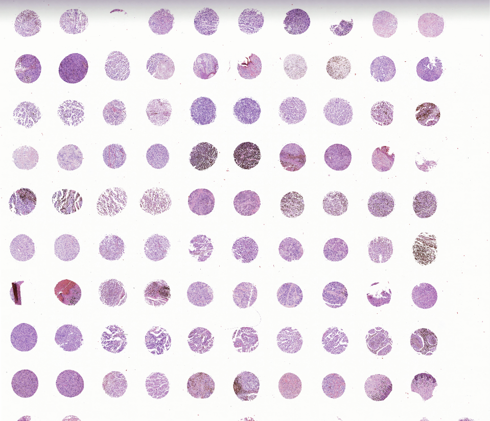 tissue microarray-MME1002a