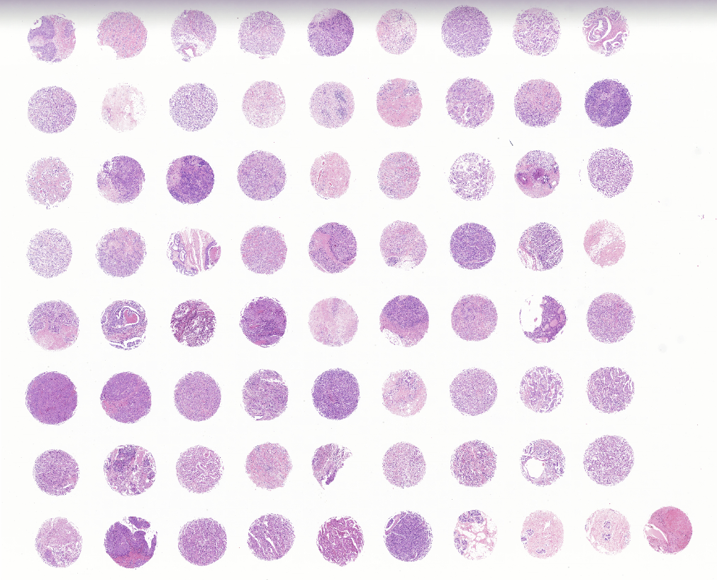 tissue microarray-FMG08013f