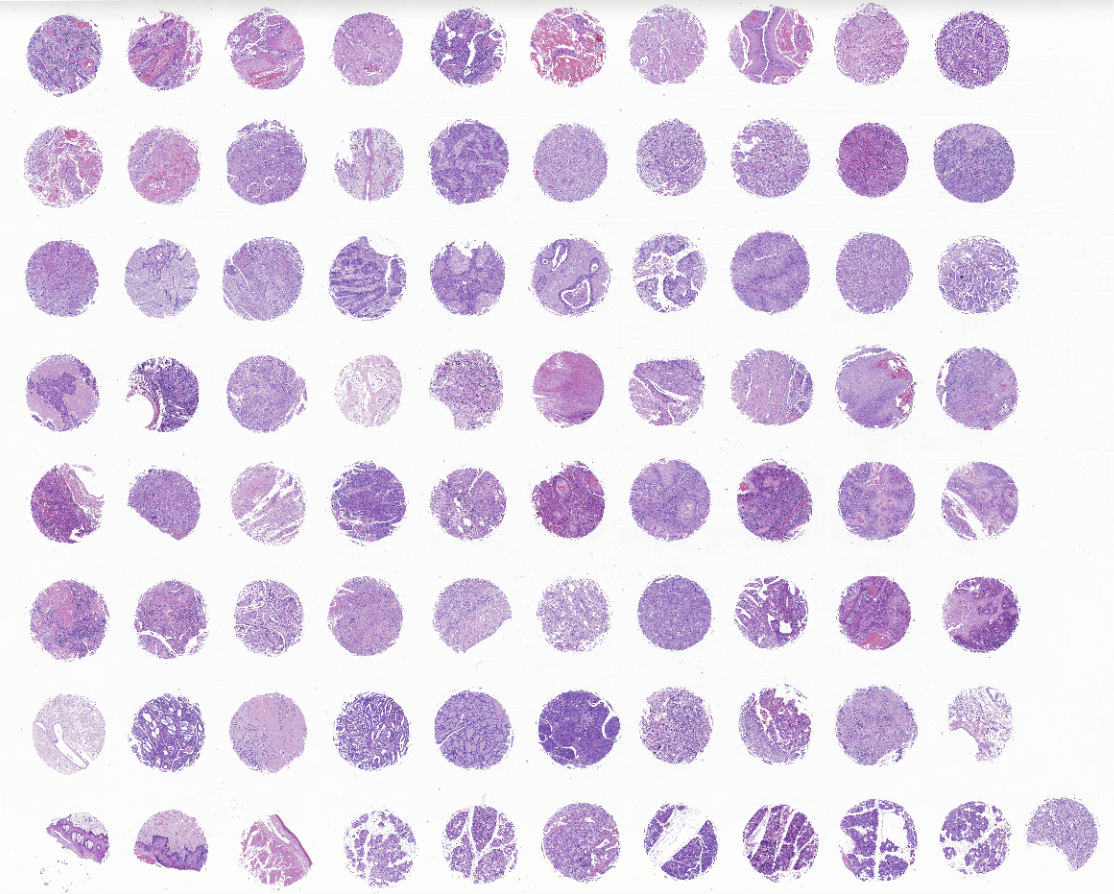 tissue microarray-XHN803