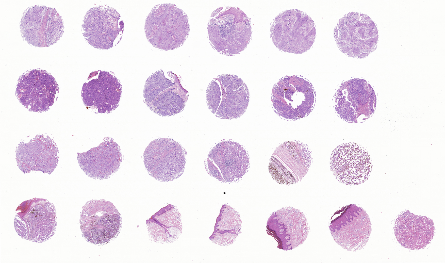 tissue microarray-KIN242a