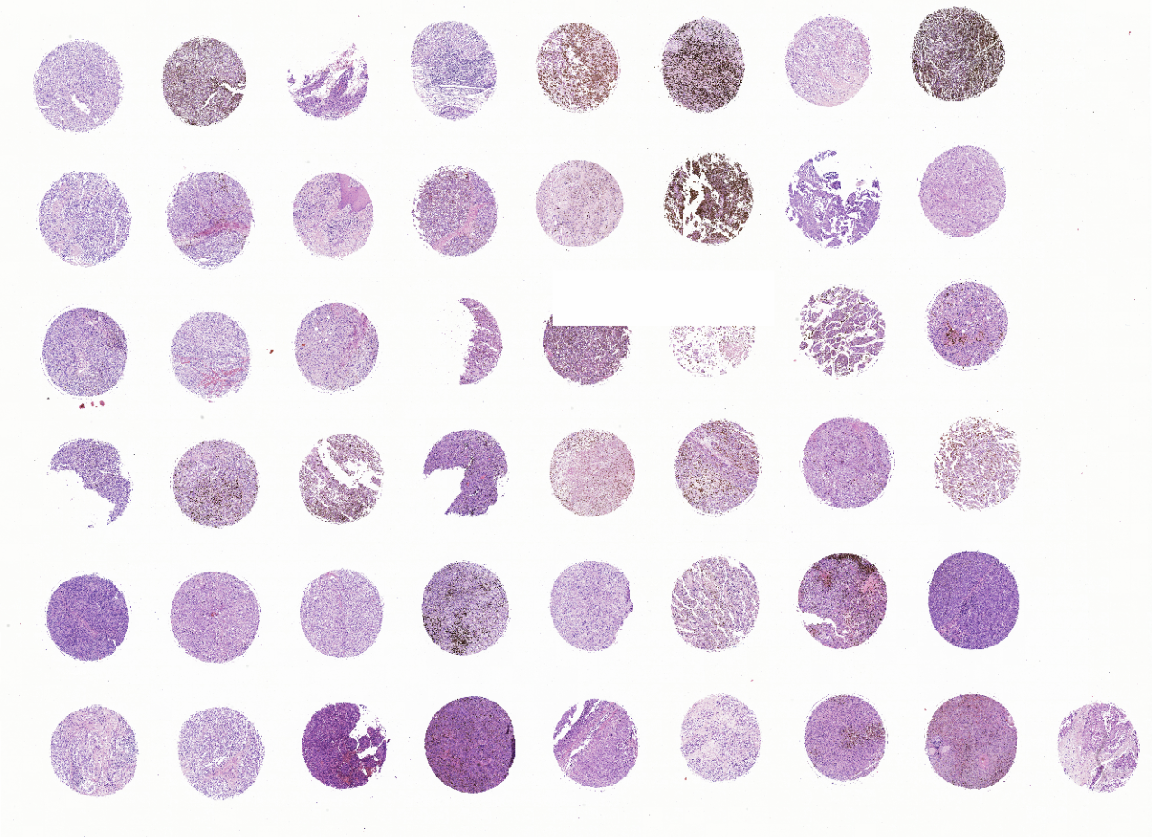 tissue microarray-MME483a