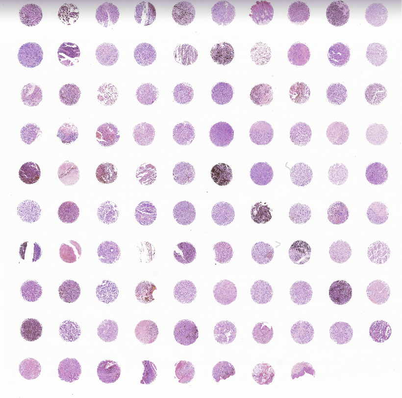 tissue microarray-MME981