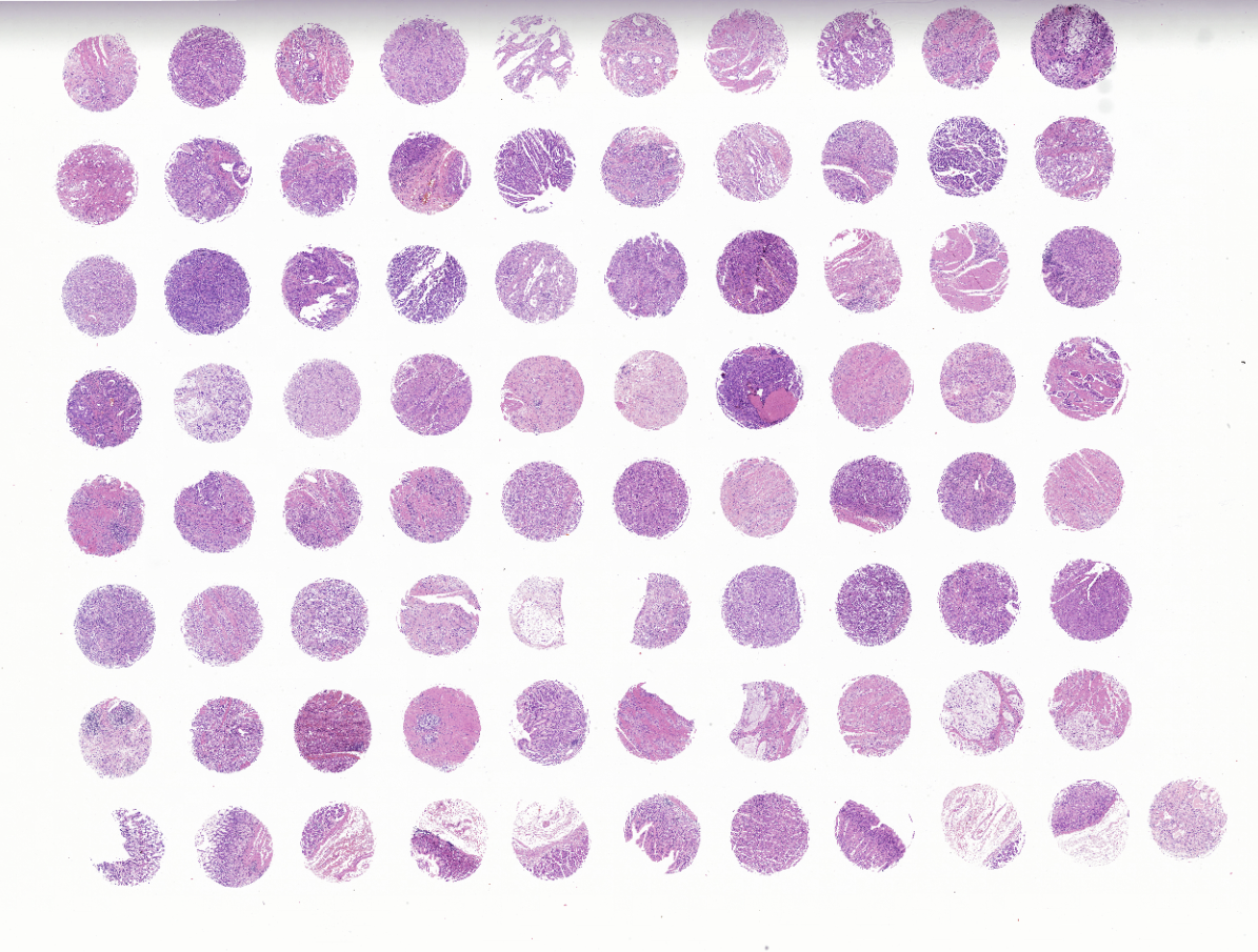 tissue microarray-FDA901